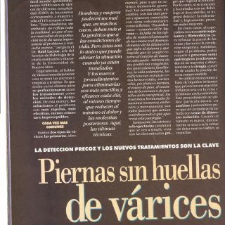 revista maxima argentina las varices y las piernas (3)